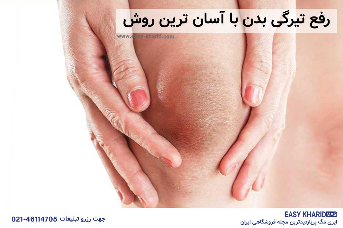 رفع تیرگی بدن با آسان ترین روش رفع تیرگی بدن با آسان ترین روش