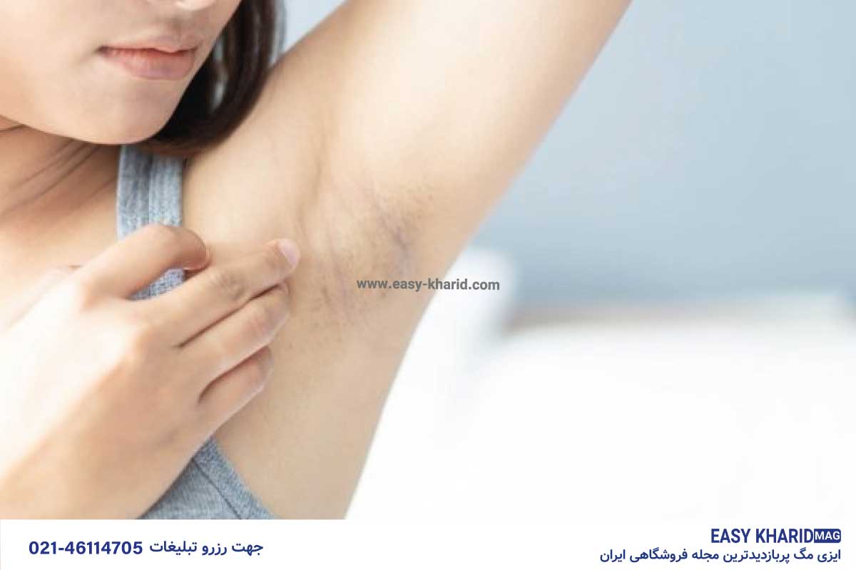 رفع تیرگی پوست با آسان ترین روش 2 49 - رفع تیرگی پوست با آسان ترین روش